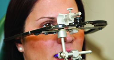 The Virtual Facebow: A digital companion to implantology