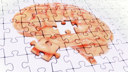 Badanie potwierdza, że ​​recesja dziąseł zwiększa ryzyko choroby Alzheimera