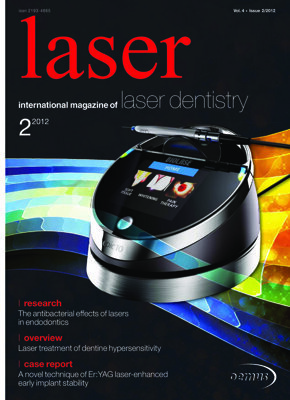 laser international No. 2, 2012
