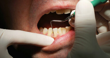 Large number of Brits unaware of consequences of poor oral health