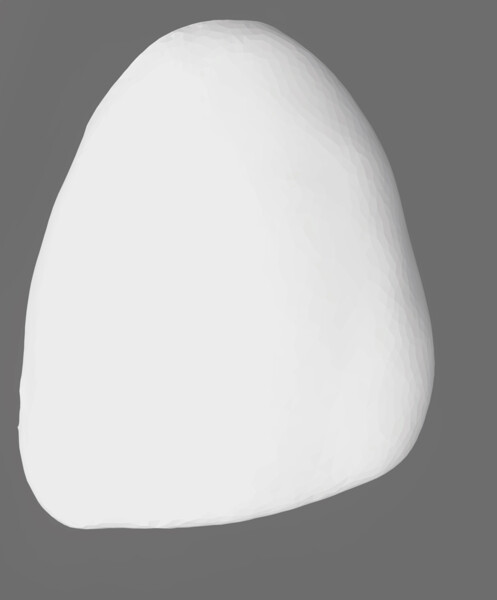 Fig. 4: Design for veneer for tooth #22, facial view.