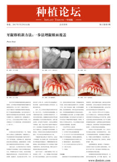 Implant Tribune China No. 2, 2017