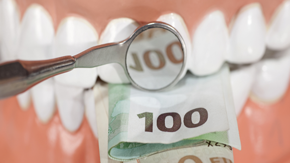 Was kostet eine professionelle Zahnreinigung?