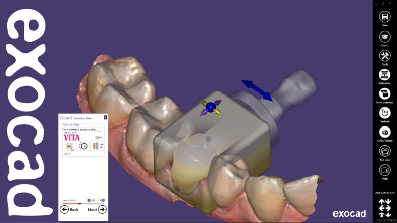 Exocad supports joint UK digital dentistry event to showcase full ChairsideCAD workflow