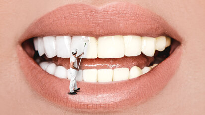 Review suggests using nanoparticles may be a better way to whiten teeth