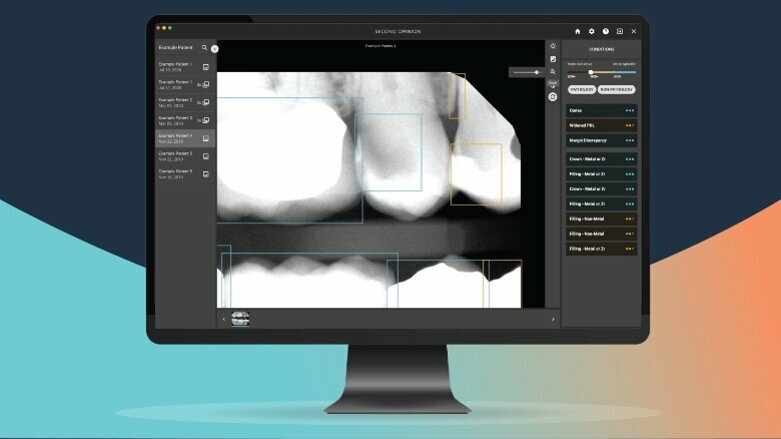 Pearl introduces AI solution for dental pathology detection
