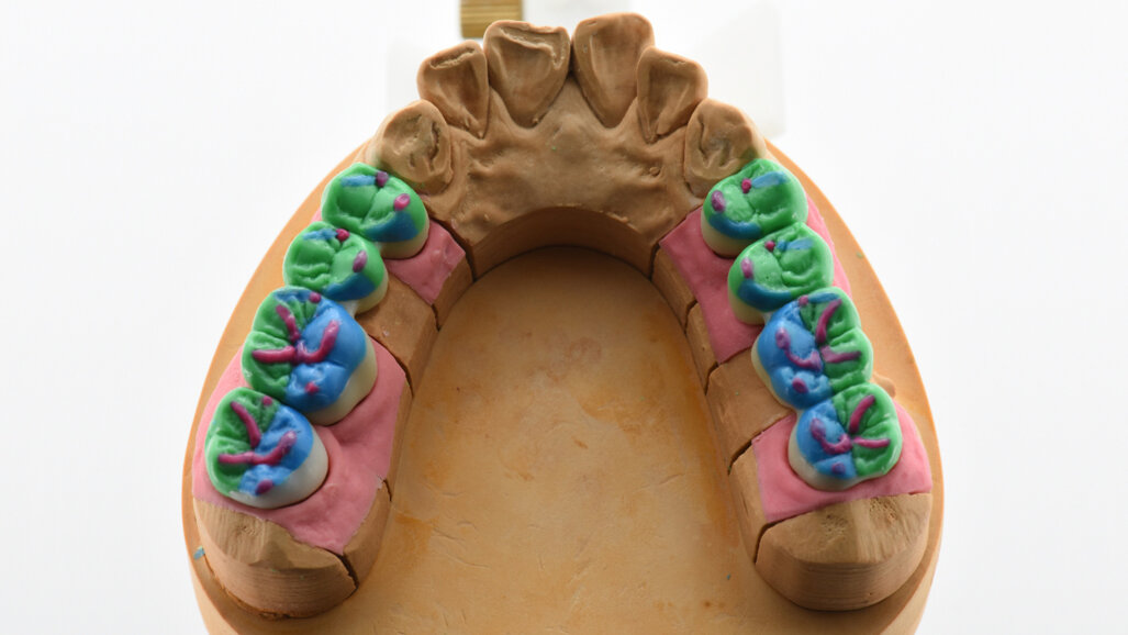 Koncept modelace okluze a sofistikované estetiky v digitální stomatologii. O krok blíže přírodě