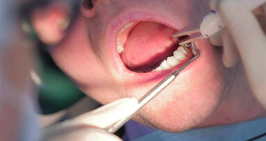 One step closer to fighting periodontitis: New dental gel reduces periodontal symptoms