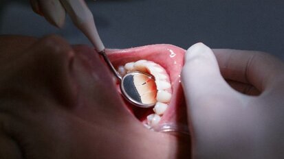 Mensen met laag inkomen gaan minder naar tandarts