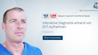 Webinar: Interaktive Diagnostik anhand von DVT-Aufnahmen