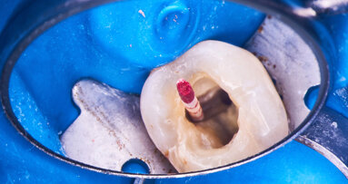 Řešení endodontických selhání