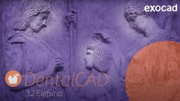 DentalCAD 3.2 Elefsina, software release highlights