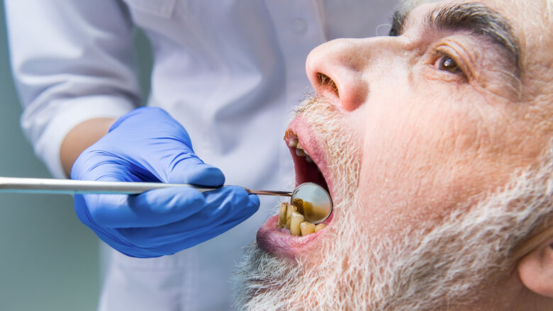 Seniors’ perception of oral health affects treatment seeking, study says
