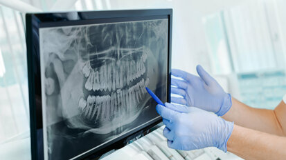 Studie: KI als Diagnostikhelfer bei Röntgenaufnahmen