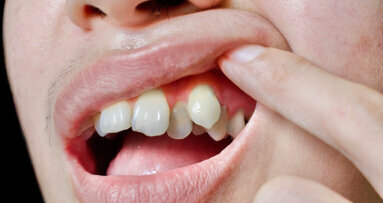 La Chine s'impose comme un marché clé de l'orthodontie et des gouttières invisibles.