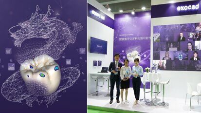 Exocad to showcase latest software solutions at Dental South China show