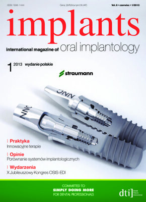 implants Poland No. 1, 2013
