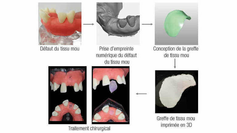 Imprimante 3D et scanner 3D pour le dentaire - Equipements