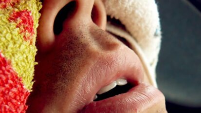 מחקר קורא לרופאי שיניים להגדיל את תפקידם בטיפול בהפרעות שינה