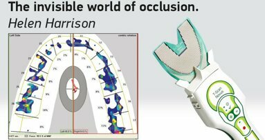 The invisible world of occlusion