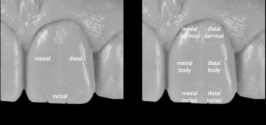 Fig. 18: Segmentation of the tooth and full segments divided into half segments.