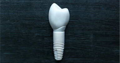 Uusi tuotantoprosessi voi tehdä keraamisista hammasimplanteista kestävämpiä