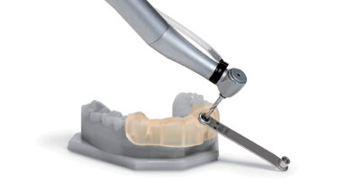 Digitální implantologie se stolní 3D tiskárnou