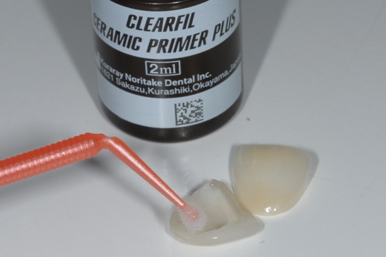 Fig. 17 CLEARFIL CERAMIC PRIMER PLUS MDP–silane primer (Kuraray Noritake Dental) applied to the veneers.