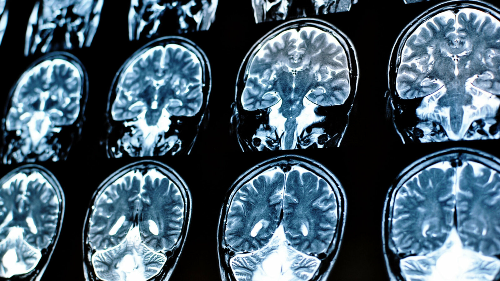 Novi dokazi ukazuju na moguću vezu između funkcije mozga i oralnog zdravlja