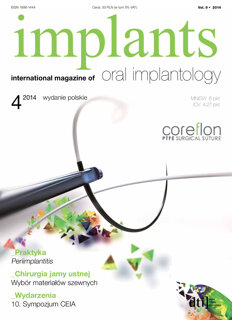 implants Poland No. 4, 2014