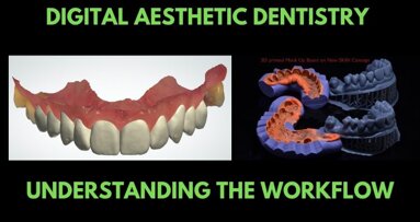 Digital Aesthetic Dentistry: 6-Step Workflow Integrates Multiple Systems, Gadgets, and Tools