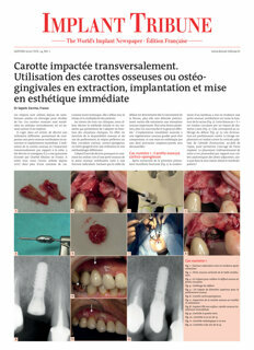 Implant Tribune France No. 1, 2022