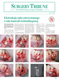 Surgery Tribune Poland No. 2, 2015