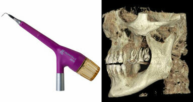 Parodontologie: Webinar thematisiert Prophylaxe und Diagnostik