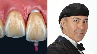 The art of ultra-aesthetic dentistry