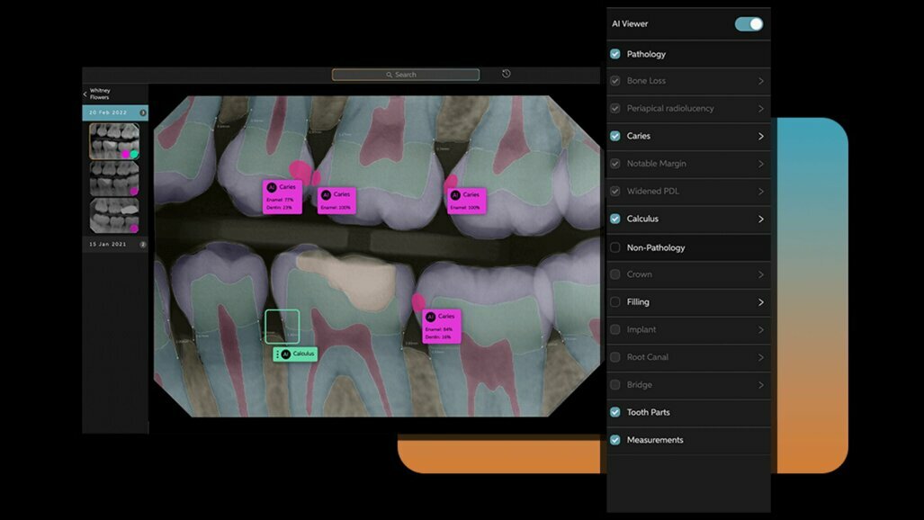 AI & ML for real time pathology detection in dentistry