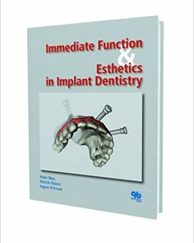 Immediate Function and Esthetics in Implant Dentistry