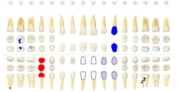 Henry Schein unveils beta version of cloud-based Dentrix Ascend practice  management system
