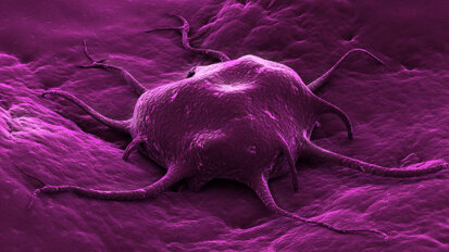 Des bactéries inoffensives vivant dans le sol, tuent le cancer avec succès