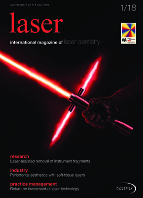laser international No. 1, 2018