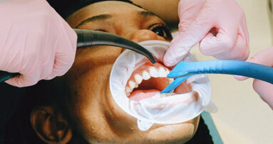 Nieuwe richtlijn Parodontologie definitief