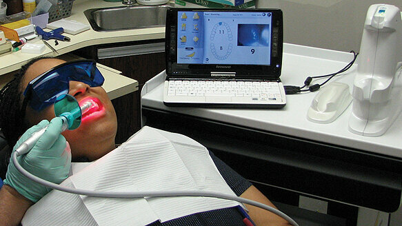 Detecting caries at the margins of restorations with The Canary System