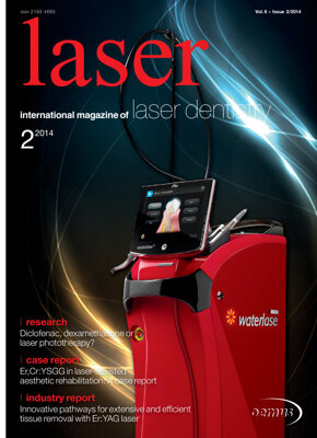 laser international No. 2, 2014