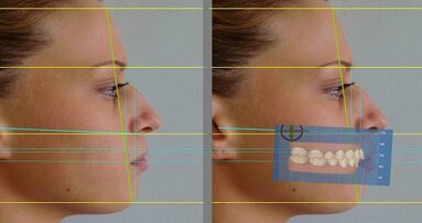 Dentofacial aesthetic analysis using 3-D software—Synergy between aesthetic dentistry and aesthetic medicine