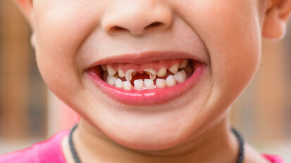 New Zealand children miss annual dental check-ups