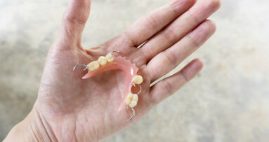 LCMD makes easy CPD designing, wax-up 