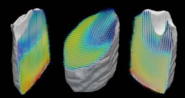 Nova técnica de imagem de raios-X  dos dentes visualiza as nanoestruturas