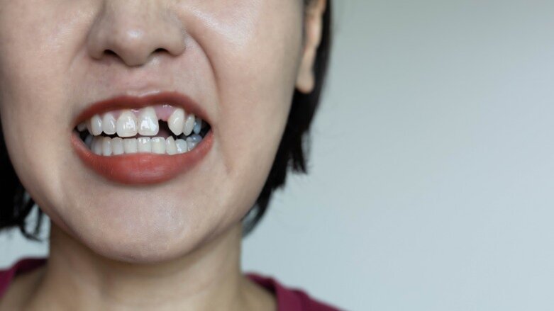 El control deficiente de la glucemia y la pérdida de dientes