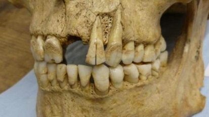 Výzkum využívá zubní plak k odkrytí složení starověké stravy