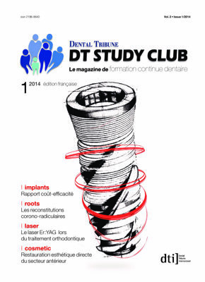 DT Study Club France No. 1, 2014